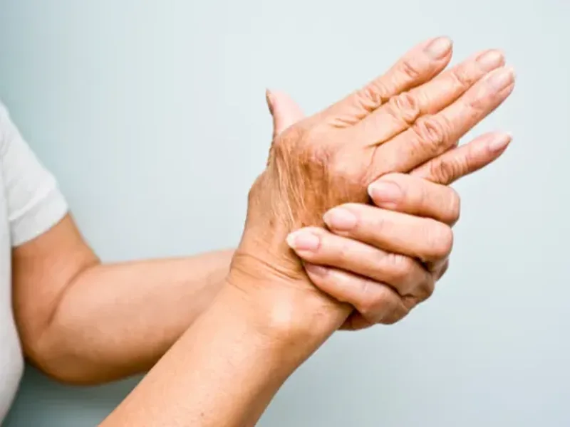 Arthritis treatment